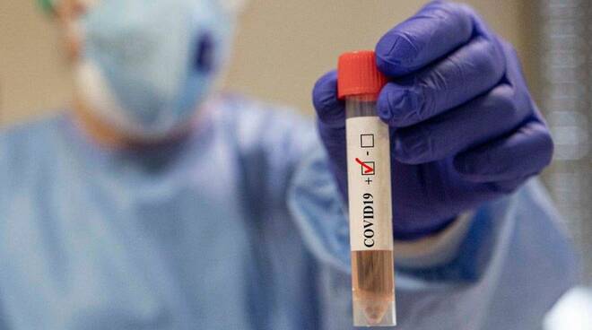 Napoli, tutti negativi i tamponi effettuati stamattina